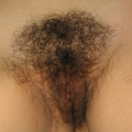 Image Fap Hairy Teen